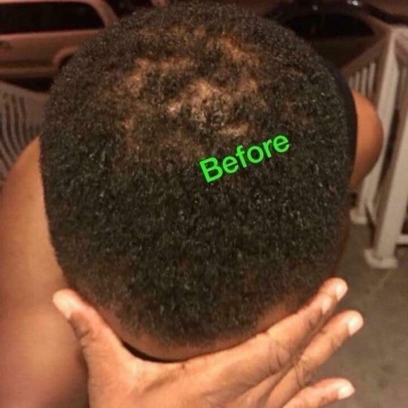 Sorduse huile capillaire pour cheveux - Picture 5 of 6